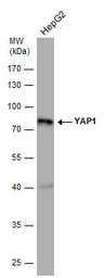 Anti-YAP1 antibody [GT256] used in Western Blot (WB). GTX633541