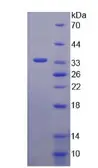 Human Apolipoprotein CIII protein, His and GST tag. GTX03431-pro