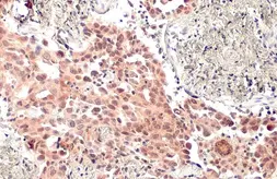 Anti-MDM2 antibody used in IHC (Paraffin sections) (IHC-P). GTX100531