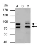 Anti-MDM2 antibody used in Immunoprecipitation (IP). GTX100531