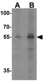 Anti-POU2F3 antibody used in Western Blot (WB). GTX17217