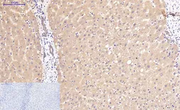 Anti-beta Catenin antibody [4F2] used in IHC (Paraffin sections) (IHC-P). GTX34339