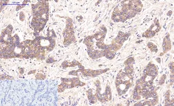 Anti-beta Catenin antibody [4F2] used in IHC (Paraffin sections) (IHC-P). GTX34339