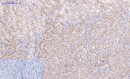 Anti-beta Catenin antibody [4F2] used in IHC (Paraffin sections) (IHC-P). GTX34339