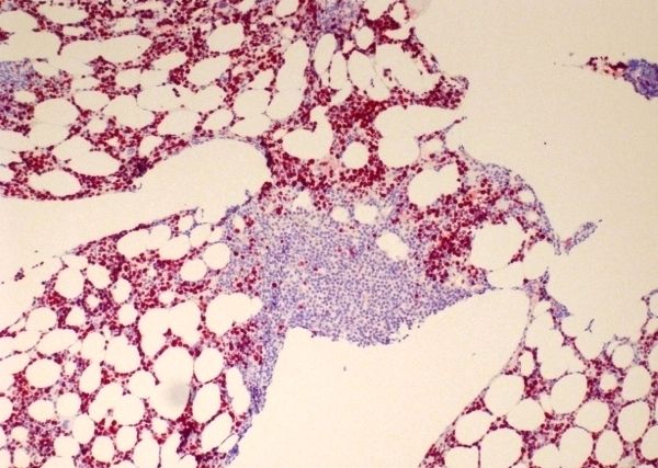 076197_Abb2_IHC-bone-marrow_Ki67_DIA-670