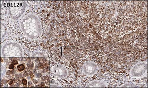 Fig.03 Immunohistochemistry with anti-CD112R clone R12