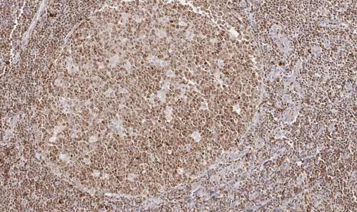 Fig.06 Immunohistochemistry with anti-CD112R clone R12