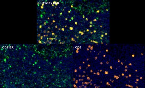 Fig.07 CD112R+CD8 multiplex IHC