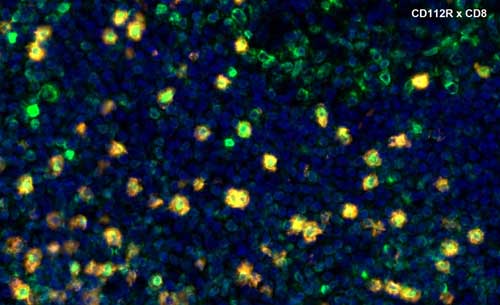 Fig.08 CD112R+CD8 multiplex IHC