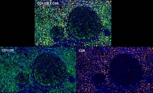 Fig.09 CD112R+CD8 multiplex IHC