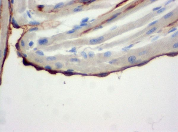 SZ31_endocardium