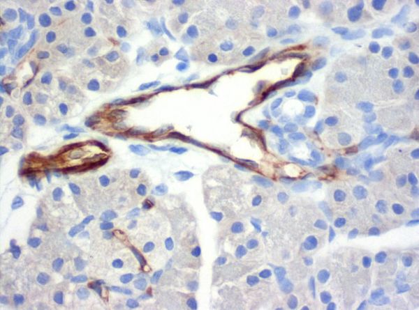 SZ31_pancreas