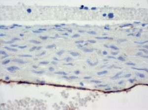 Immunohistochemical staining (IHC) with anti-CD31 (PECAM-1) Antibody (clone SZ31) - dianova