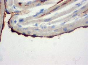 Immunohistochemical staining (IHC) with anti-CD31 (PECAM-1) Antibody (clone SZ31) - dianova