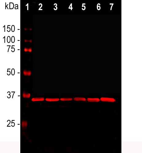 Western Blot