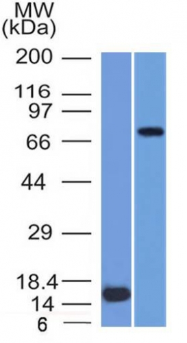 MMP2 / Collagenase Type IV A (Tumor Metastasis Marker) Antibody