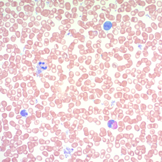 Giemsa Stain Kit (May-Grunwald)