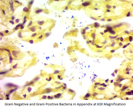 Gram Stain Kit