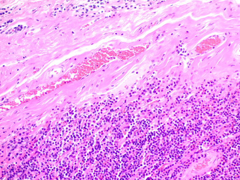 Hematoxylin, Mayer's (Lillie's Modification)