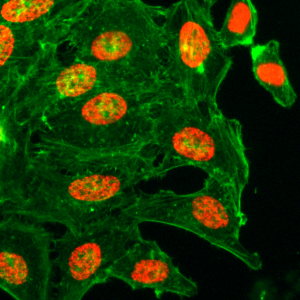 Immunocytochemistry