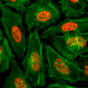 Immunocytochemistry