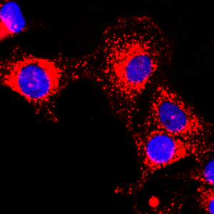 Immunocytochemical