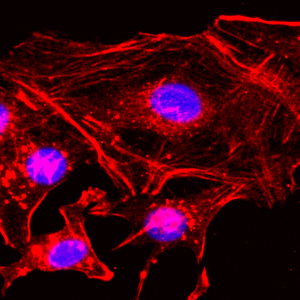 Immunocytochemical