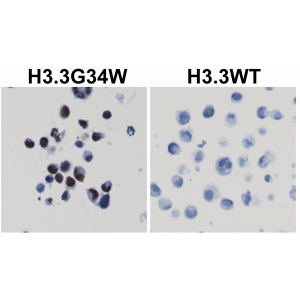 Immunohistochemical