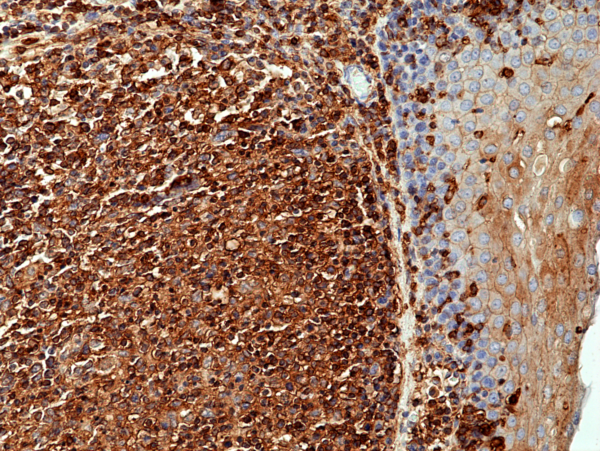 Immunocytochemical