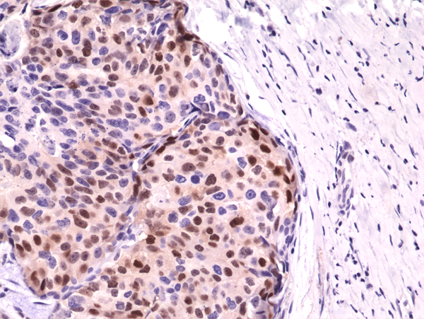 Immunohistochemical