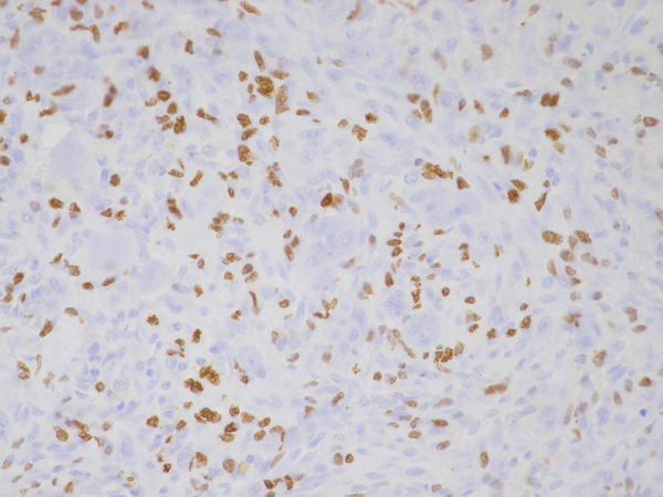 Immunohistochemical