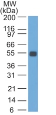 Western Blot analysis of Rat Colon lysate probed with Ep-CAM Mouse Monoclonal Antibody (GZ-1).