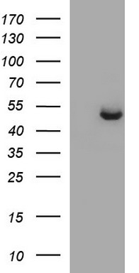 SPHK1 Mouse Monoclonal Antibody [Clone ID: OTI1A6]