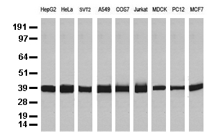 GAPDH Mouse Monoclonal Antibody [Clone ID: OTI2D9]