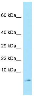 Small EDRK rich factor 1 (SERF1A) Rabbit Polyclonal Antibody