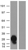 Rabbit Polyclonal turboGFP Antibody