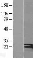 Interferon gamma (IFNG) (NM_000619) Human Over-expression Lysate