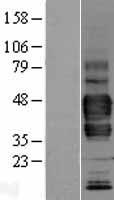 LYVE1 (NM_006691) Human Over-expression Lysate