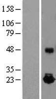 IL10 (NM_000572) Human Over-expression Lysate