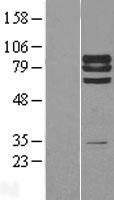 PTP epsilon (PTPRE) (NM_006504) Human Over-expression Lysate