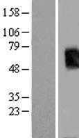 Tpit (TBX19) (NM_005149) Human Over-expression Lysate