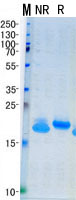 IL10 (NM_000572) Human Recombinant Protein