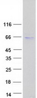 Adipose Triglyceride Lipase (PNPLA2) (NM_020376) Human Recombinant Protein