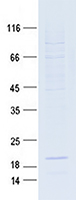 KK LC 1 (CT83) (NM_001017978) Human Recombinant Protein