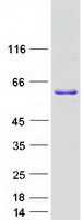 WW domain binding protein 4 (WBP4) (NM_007187) Human Recombinant Protein