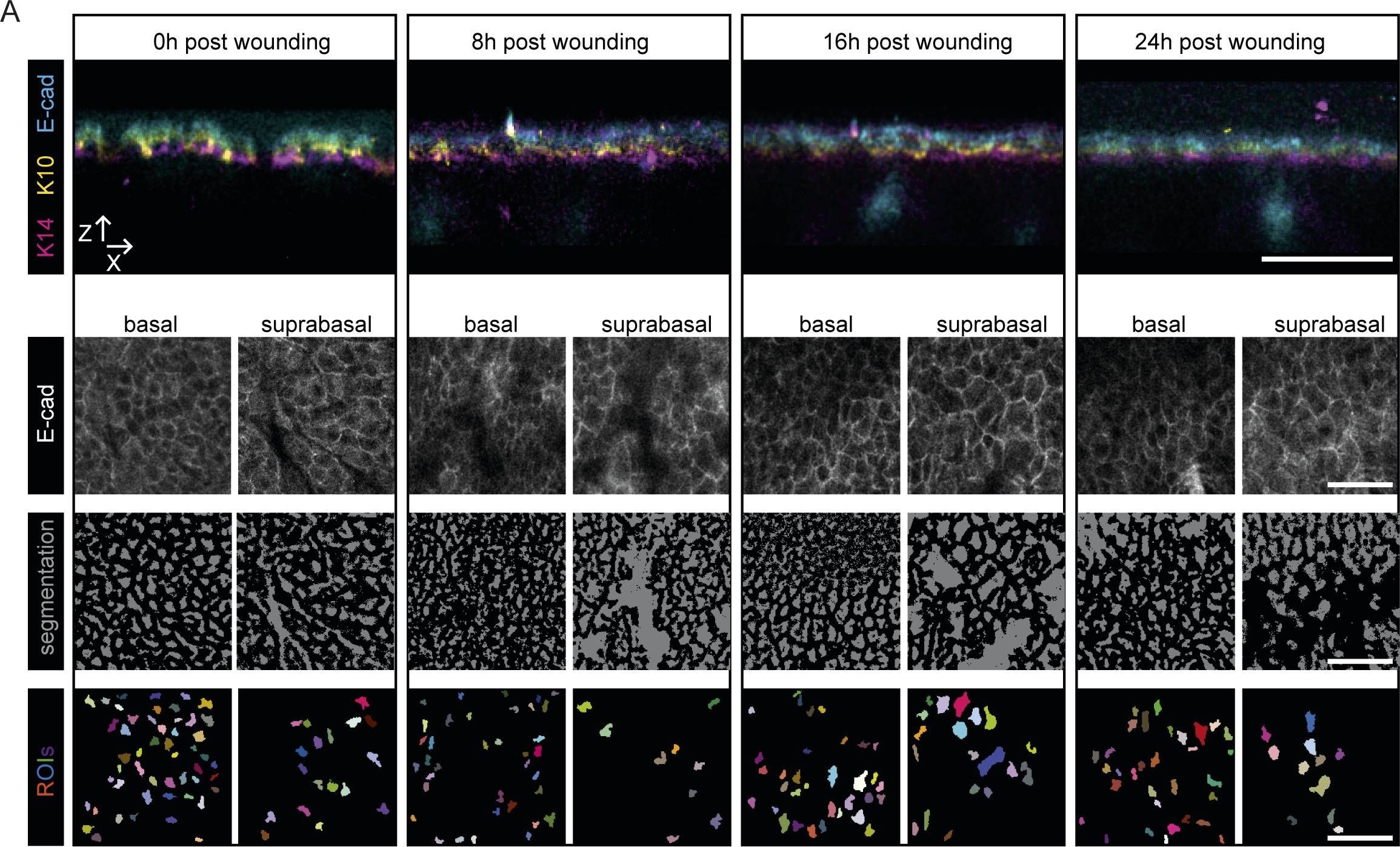 Scratch-induced partial skin wounds re-epithelialize by sheets of independently migrating keratinocytes.