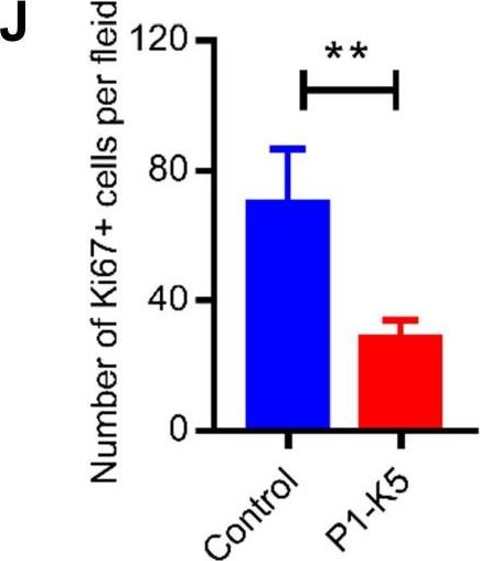 PINCH-1 promotes IGF-1 receptor expression and skin cancer progression through inhibition of the GRB10-NEDD4 complex.