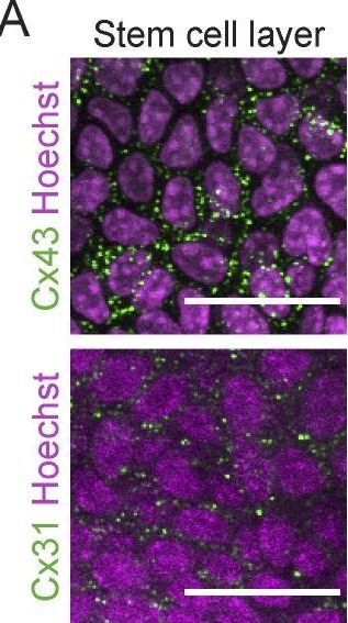 Cell cycle controls long-range calcium signaling in the regenerating epidermis.