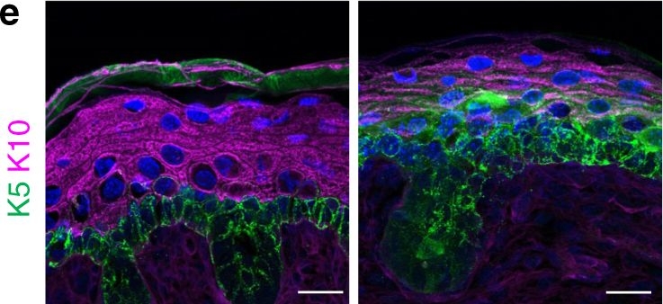 Beclin 1 regulates recycling endosome and is required for skin development in mice.