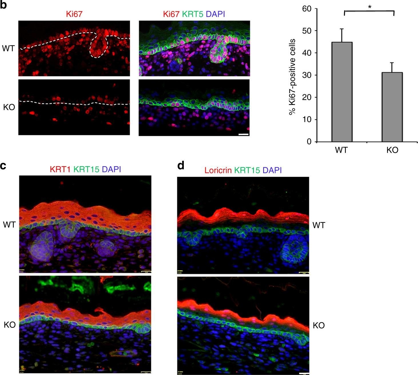 The RNA-binding protein YBX1 regulates epidermal progenitors at a posttranscriptional level.